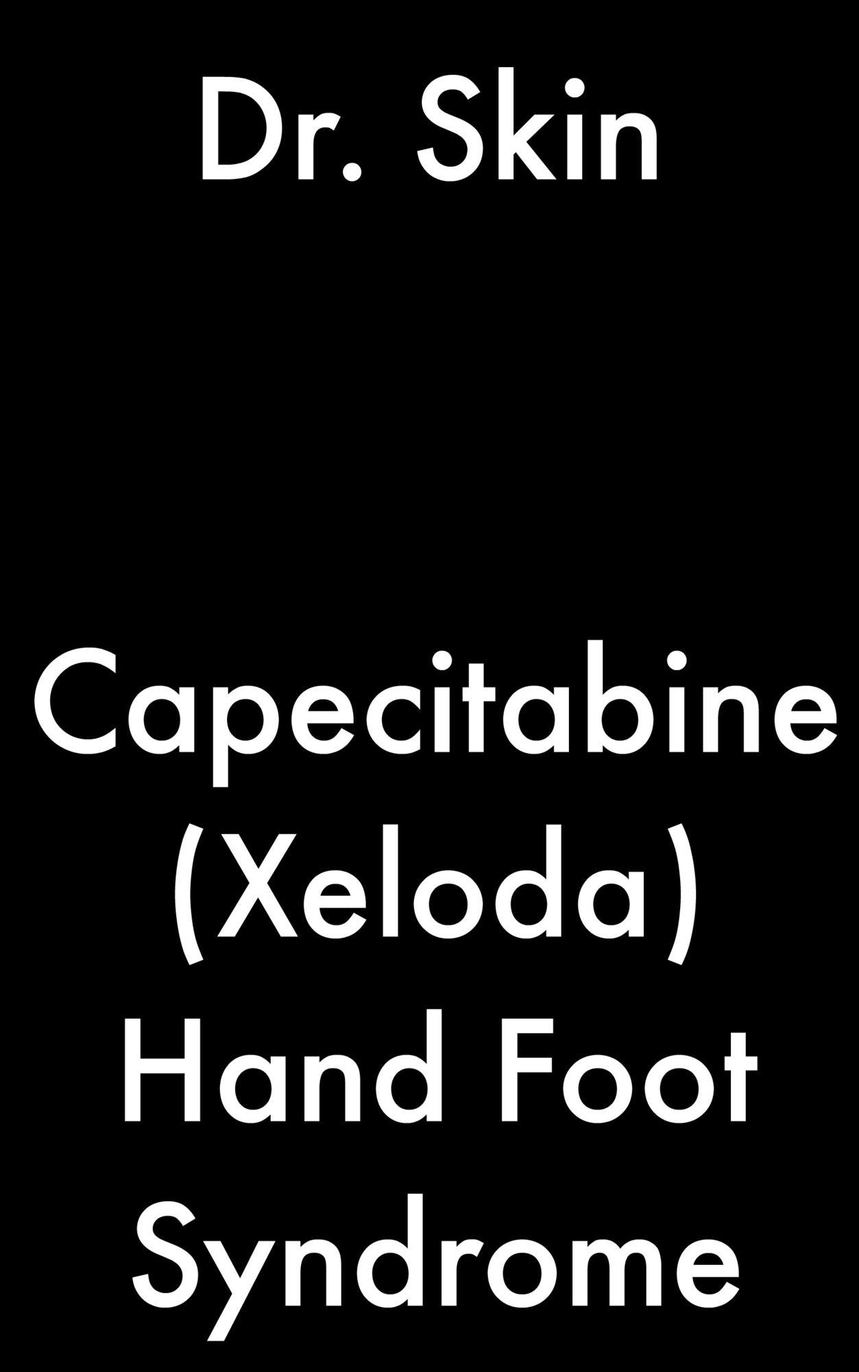 Capecitabine (Xeloda) Hand Foot Syndrome