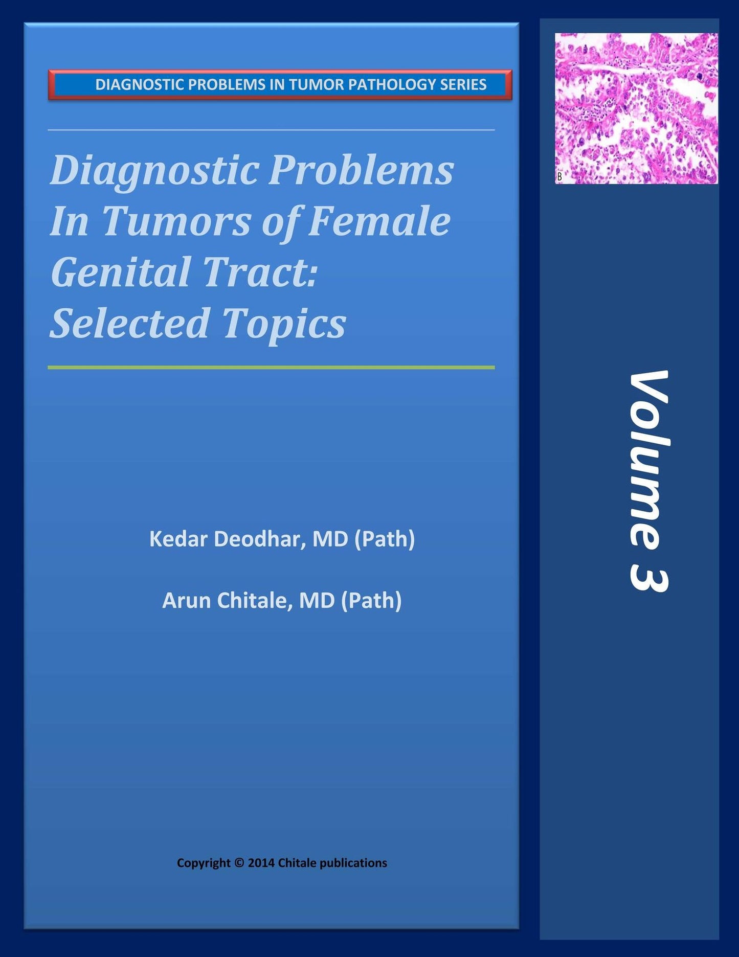 Diagnostic Problems in Tumors of Female Genital Tract: Selected Topics