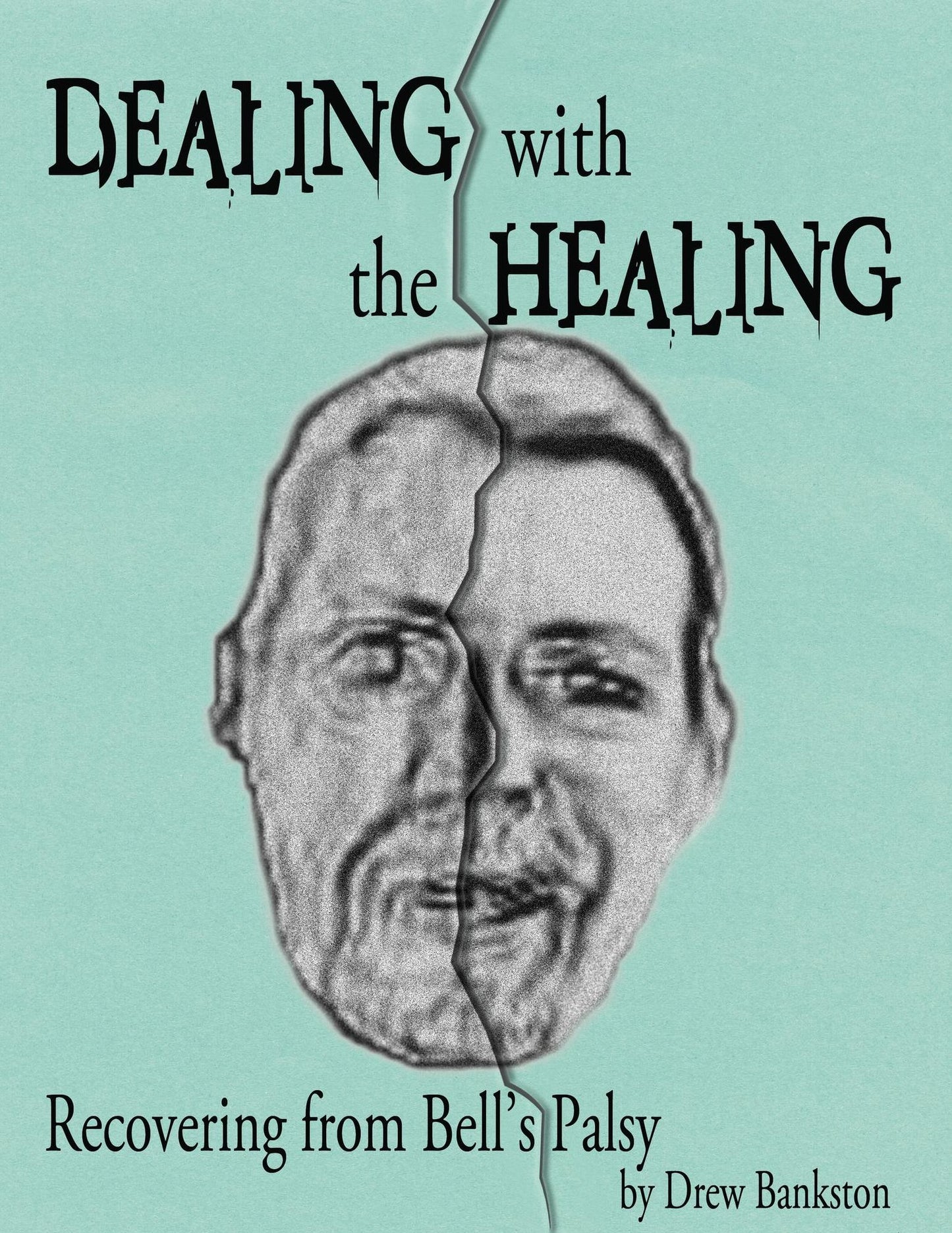 Dealing with the Healing: Recovering From Bell's Palsy