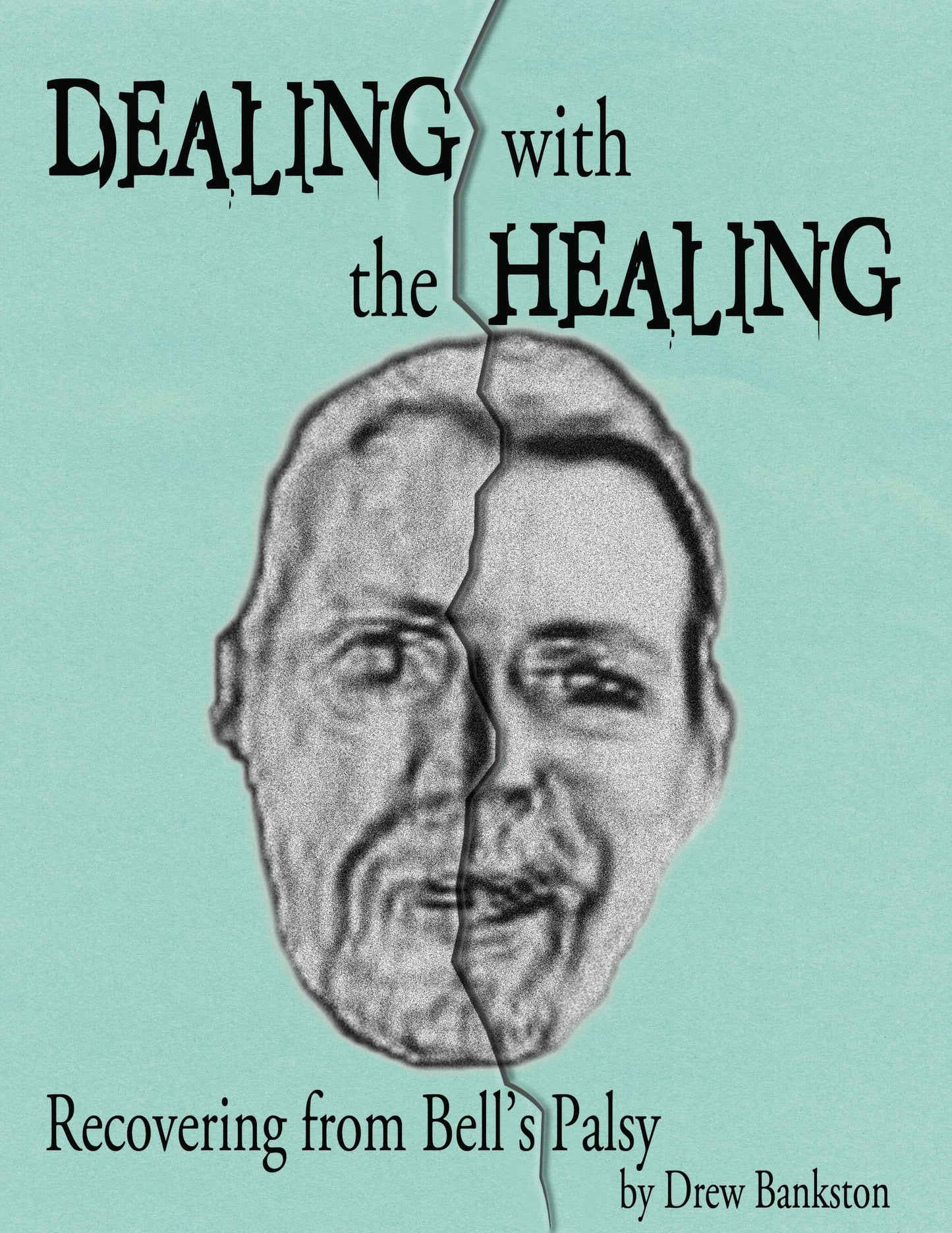 Dealing with the Healing: Recovering From Bell's Palsy