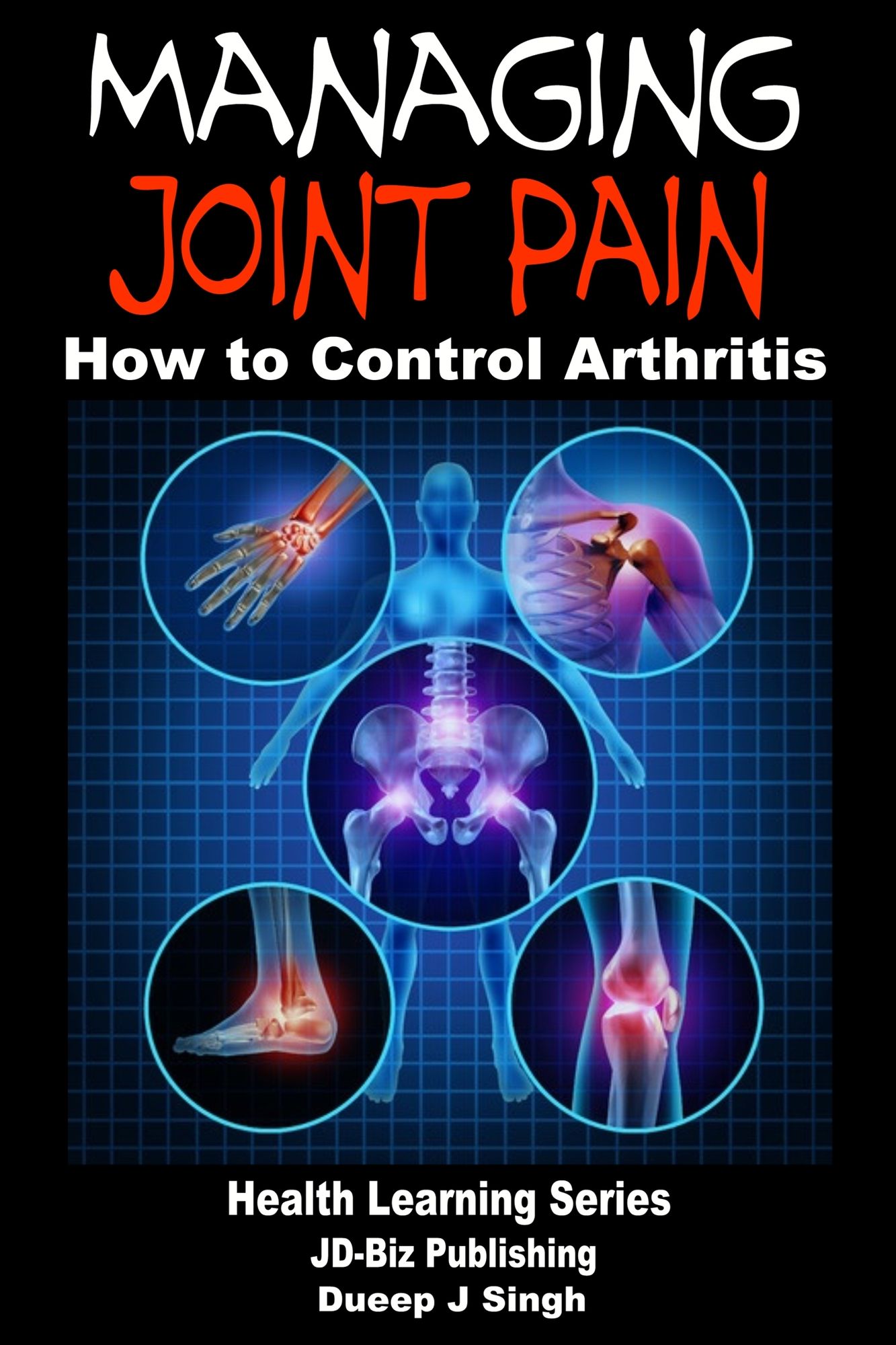 Managing Joint Pain: How to Control Arthritis