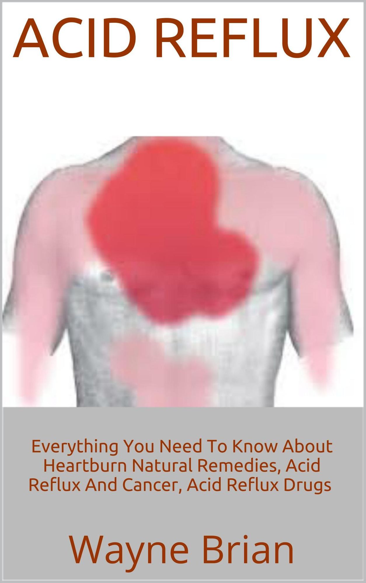 Acid Reflux: Everything You Need To Know About Heartburn Natural Remedies, Acid Reflux And Cancer, Acid Reflux Drugs