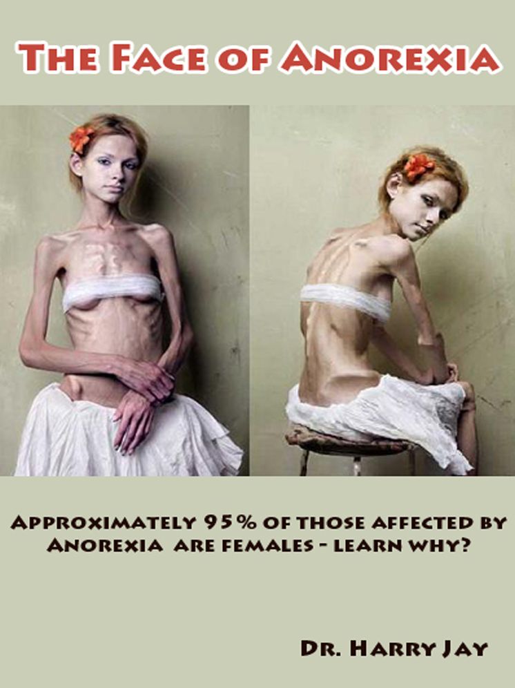 The Face of Anorexia