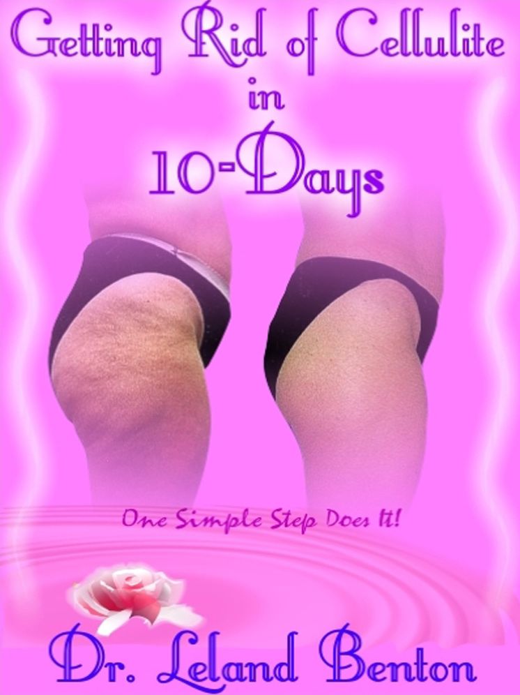 Getting Rid of Cellulite in 10-Days