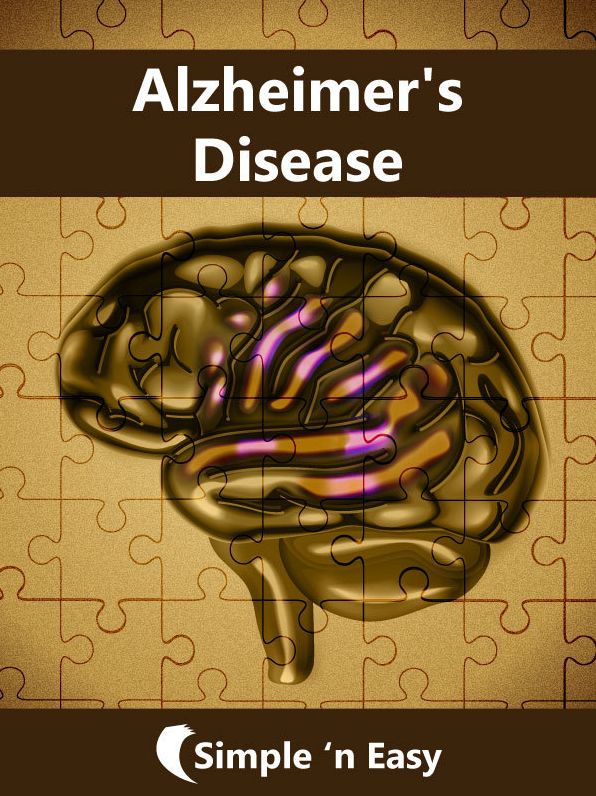 Alzheimer
