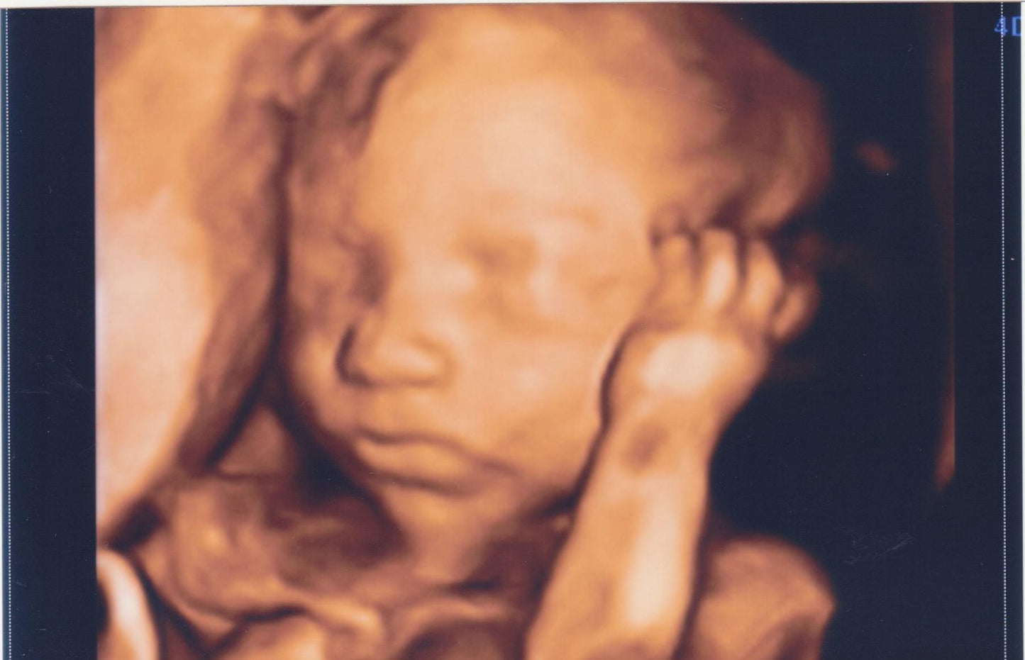 3D 4D Baby Imaging Ultrasound Service Start Up Sample Business Plan!