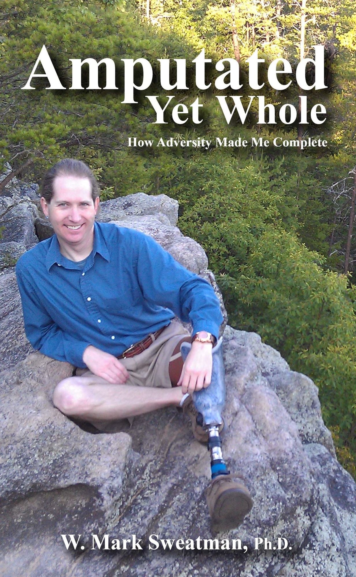 Amputated Yet Whole: How Adversity Made Me Complete