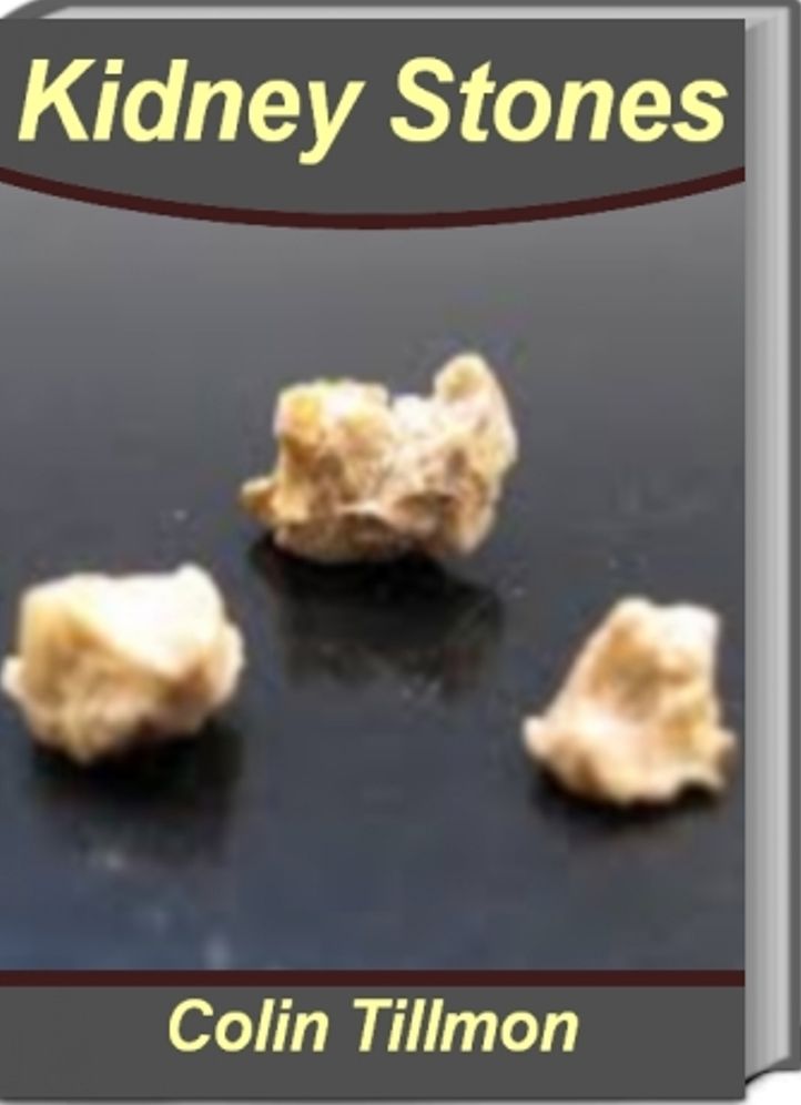 Kidney Stones: The Go-To Guide for Learning About Passing Kidney Stones, Signs of Kidney Stones, Kidney Stones Treatment, What Causes Kidney Stones, Kidney Stones Diet