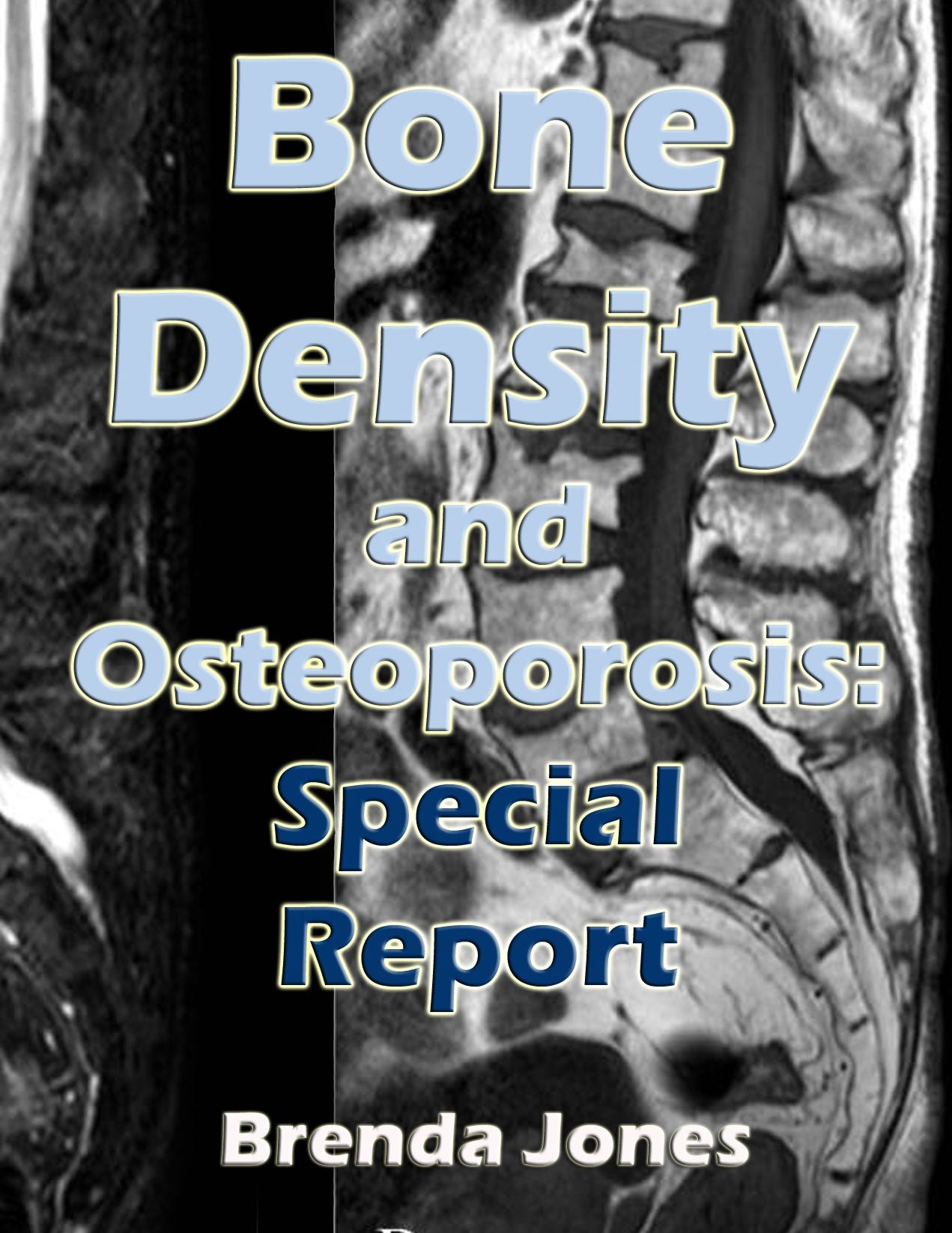 Bone Density and Osteoporosis - Special Report