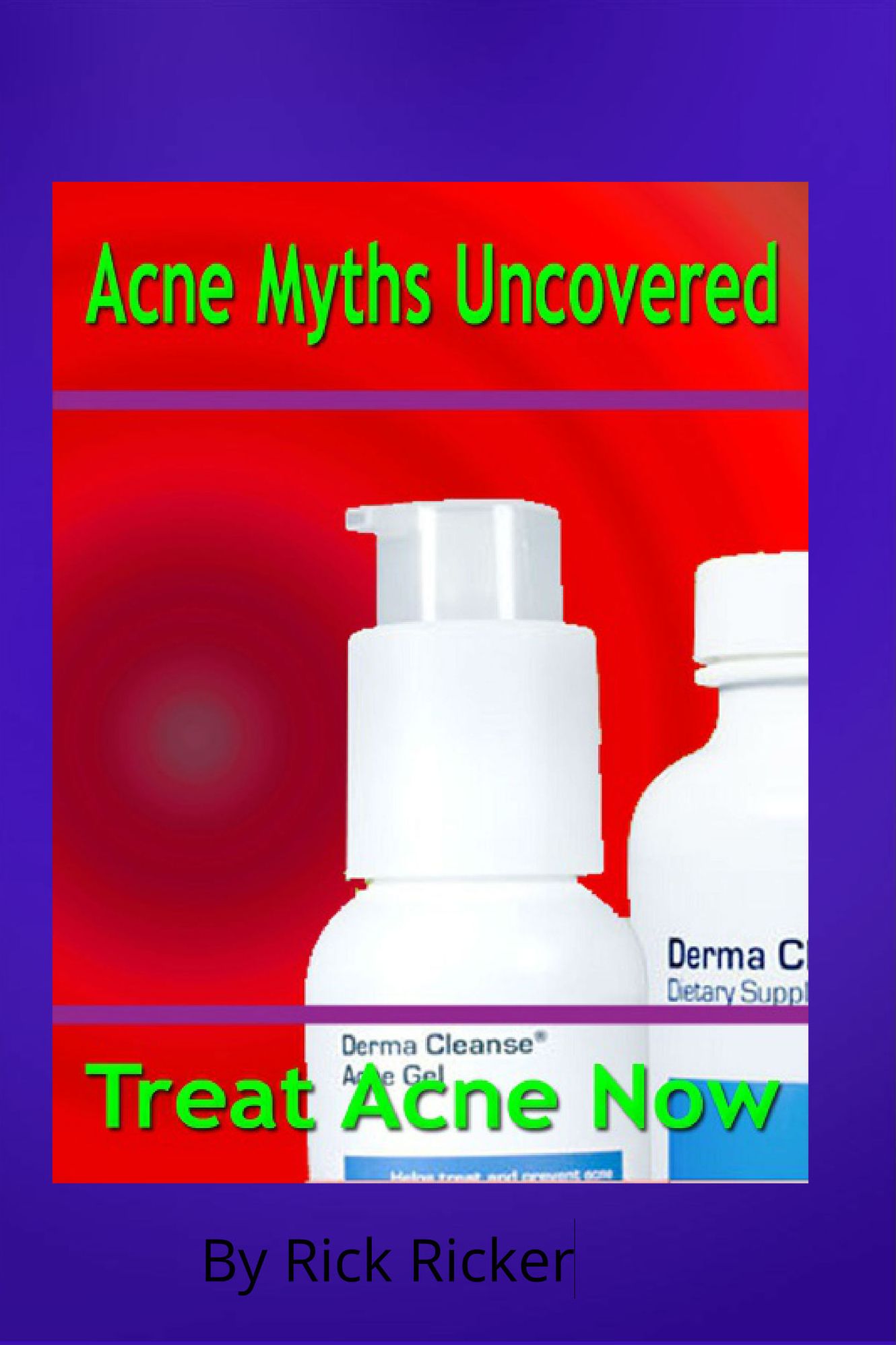 Acne Myths Uncovered