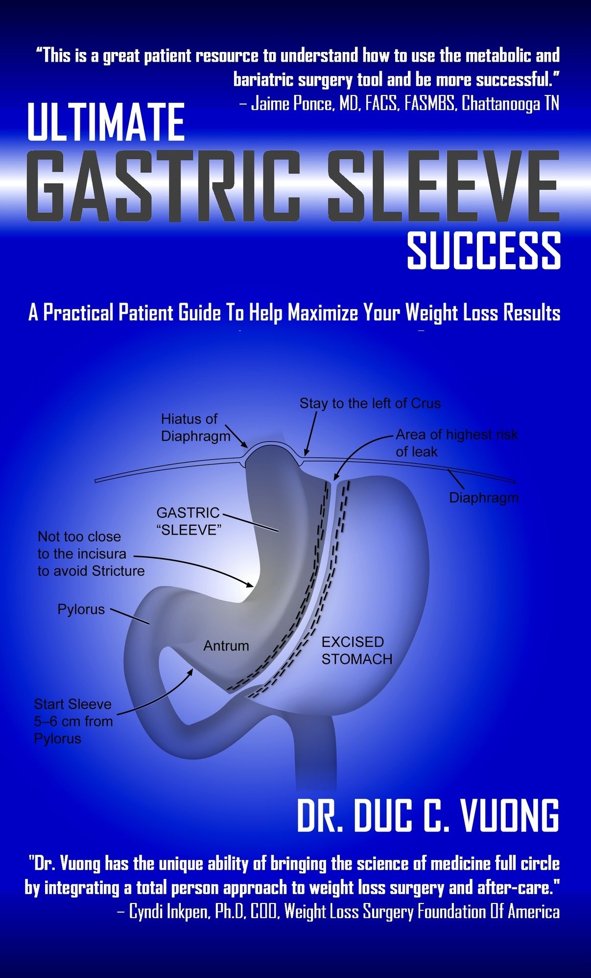 Ultimate Gastric Sleeve Success: A Practical Patient Guide To Help Maximize Your Weight Loss Results