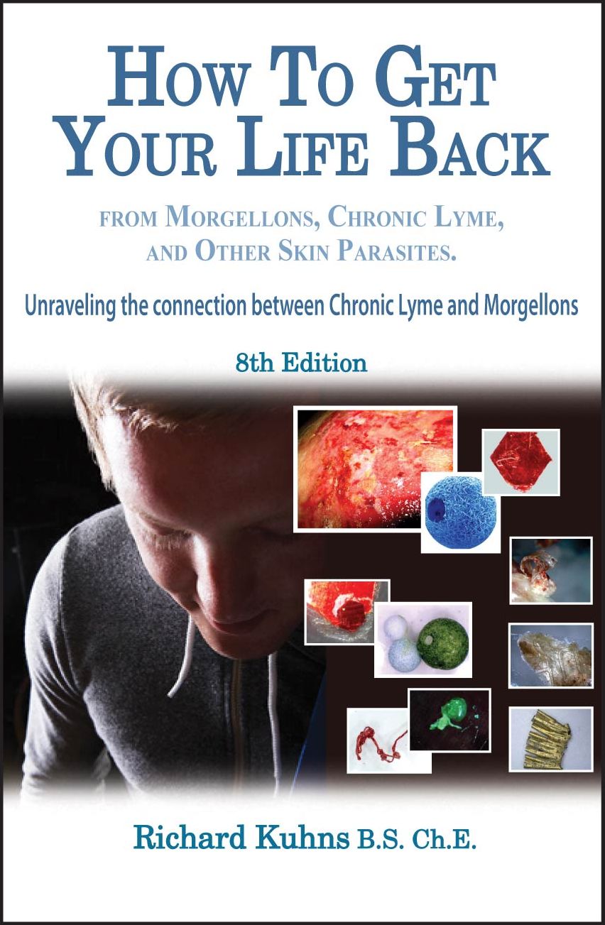 How To Get Your Life Back From Morgellons and Other Skin Parasites