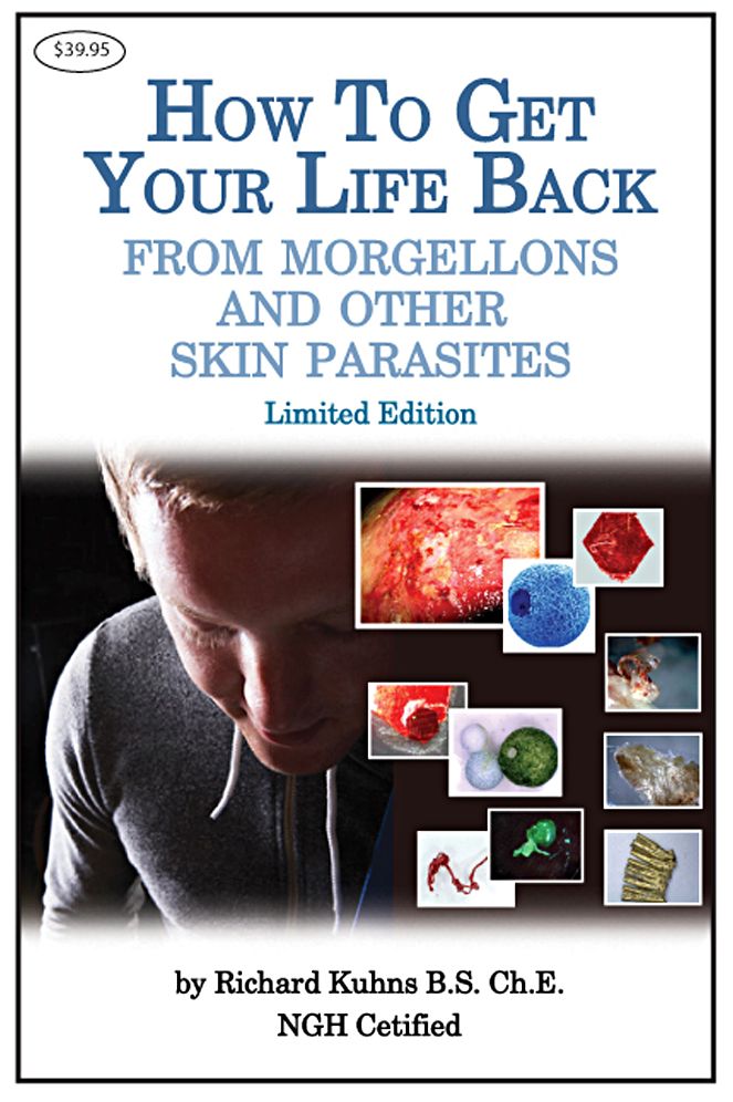 How To Get Your Life Back From Morgellons and Other Skin Parasites