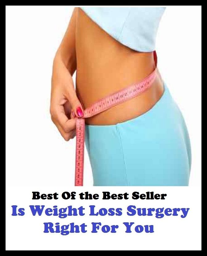 Best of the best sellers Is Weight Loss Surgery Right For You ( exercise, meditation, acupuncture, disease, digestive system, formula, medicine, remedy, fix, treatment, action, conduct, behavior, handling, gastrin, fitness, vitamins )