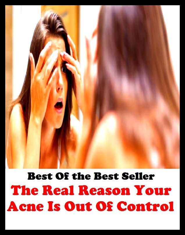 Best of the best sellers The Real Reason Your Acne Is Out Of Cont ( exercise, meditation, acupuncture, disease, digestive system, formula, medicine, remedy, fix, treatment, action, conduct, behavior, handling, gastrin, fitness )