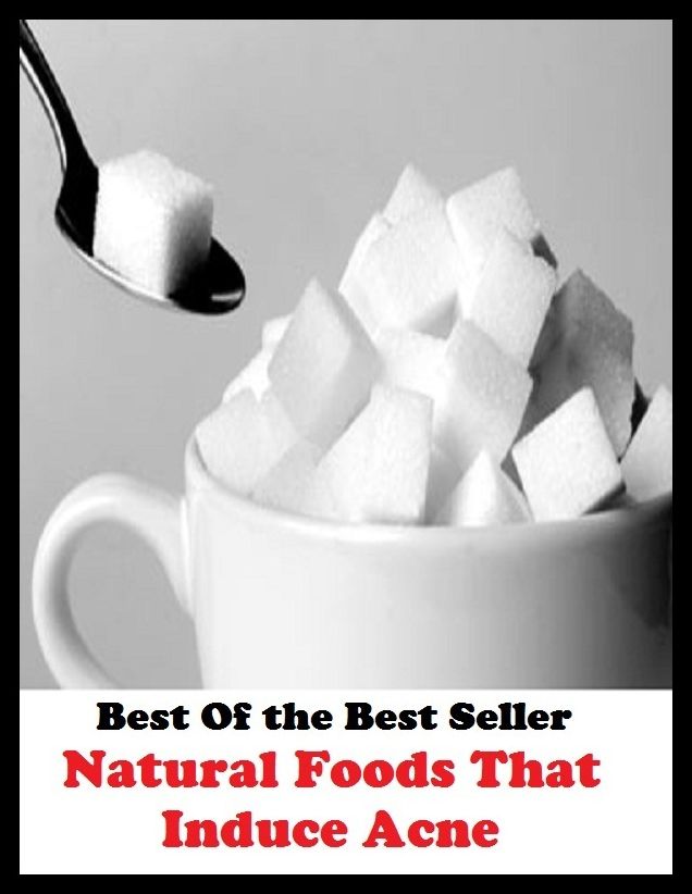 Best of the best sellers Natural Foods That Induce Acne ( exercise, meditation, acupuncture, disease, digestive system, formula, medicine, remedy, fix, treatment, action, conduct, behavior, handling, gastrin, fitness, vitamins, healing )