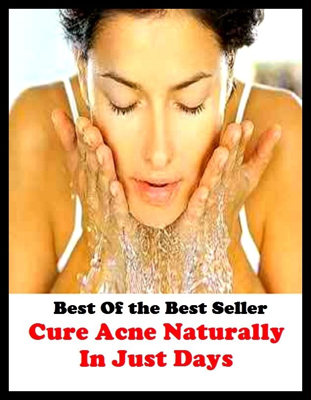 Best of the best sellers Cure Acne Naturally In Just Days ( exercise, meditation, acupuncture, disease, digestive system, formula, medicine, remedy, fix, treatment, action, conduct, behavior, handling, gastrin, fitness, vitamins )
