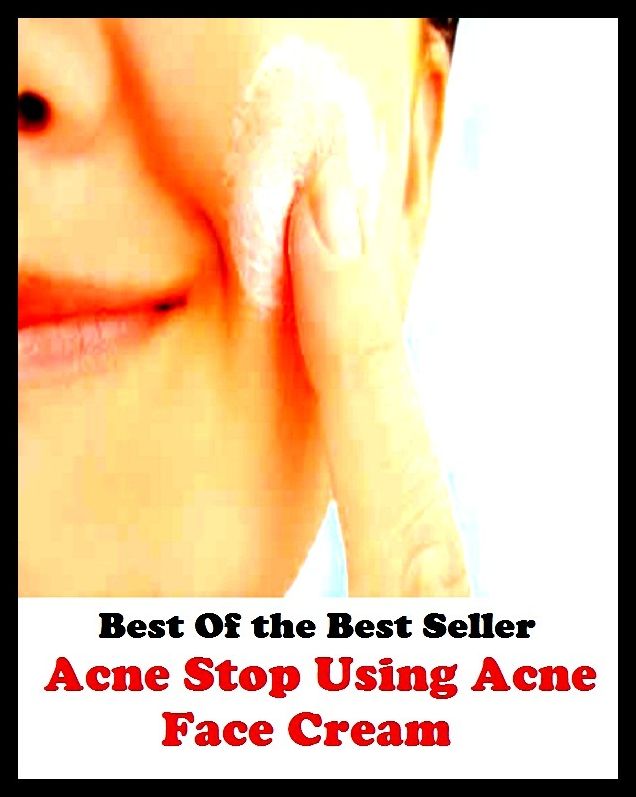 Best of the best sellers Acne Step Using Acne Face Cream ( exercise, meditation, acupuncture, disease, digestive system, formula, medicine, remedy, fix, treatment, action, conduct, behavior, handling, gastrin, fitness, vitamins )