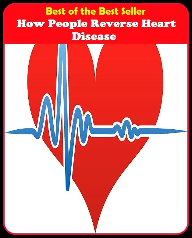 Best of the best seller How . People Reverse Heart Disease(energy,fitness,strength,well-being,bloom,complexion,constitution,euphoria,fettle,form)