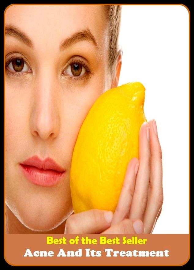 Best of the best seller Acne And Its Treatment(energy,fitness,strength,well-being,bloom,complexion,constitution,euphoria,fettle,form)