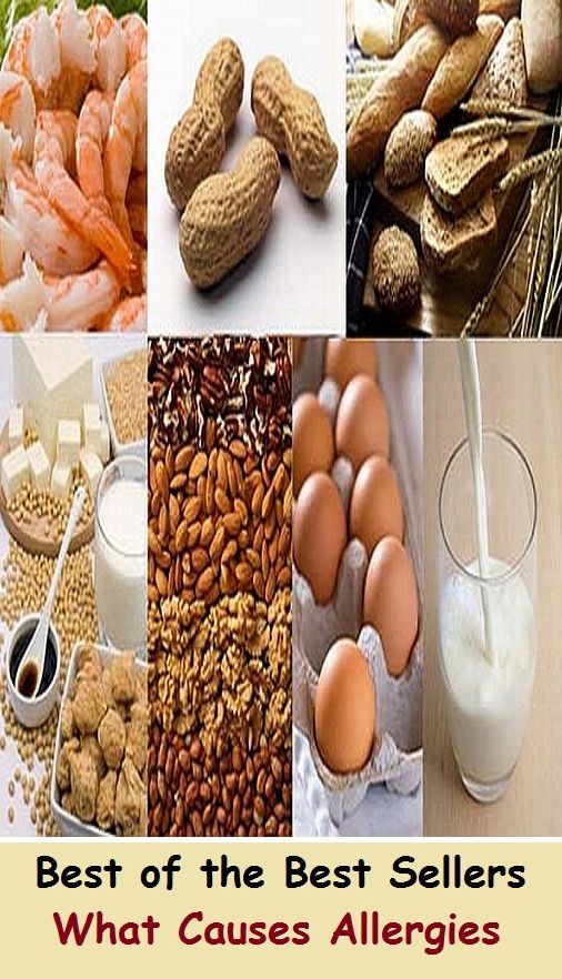 Best of the Best Sellers What Causes Allergies (allergy, aversion, enmity, disgust, distaste, disorder, sensibility, sensitivity, reaction, phobia)