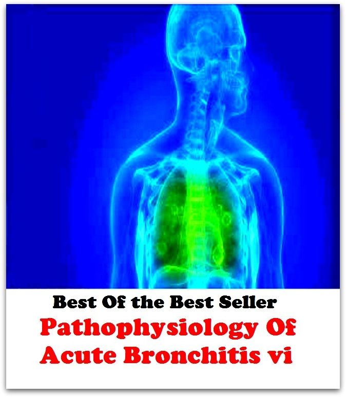 Best of the Best Sellers Pathophysiology Of Acute Bronchitis vi( respiratory disease, tuberculous rheumatism, visceral rheumatism, neuritis, glossitis, sceral rheumatism, arthritis deformans, irritable bowel, sore throat, osteomyelitis )