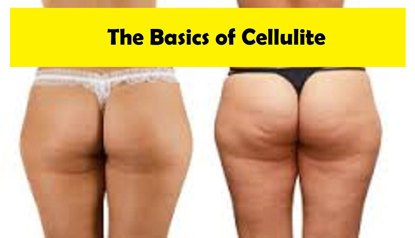 The Basics of Cellulite