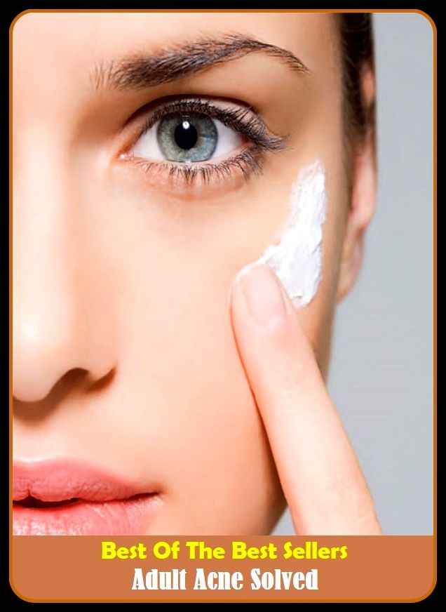 Skincare: Adult Acne Solved ( acme lease, acne, acne festivals, acne celluloid, acne Cesaro, acne vulgarism, caned, cuneiform, cuneiform eruptions, Alcestis)