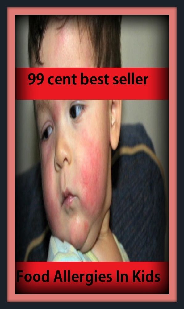 Kids book: 99 cent best seller Food Allergies In Kids (foobar, foo chow, food, food additive, food additives, food allergy, food and agriculture organization, food and agriculture organization of the united nations, food and beverages )