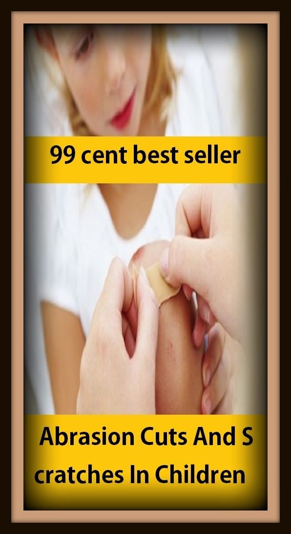 99 cent best seller Abrasion Cuts And Scratches In Children (sabra, abrade, brasserie, abash, abrasion, abrasion platform, abrasive, abrasive blasting, abrasive disc, abrasive material)