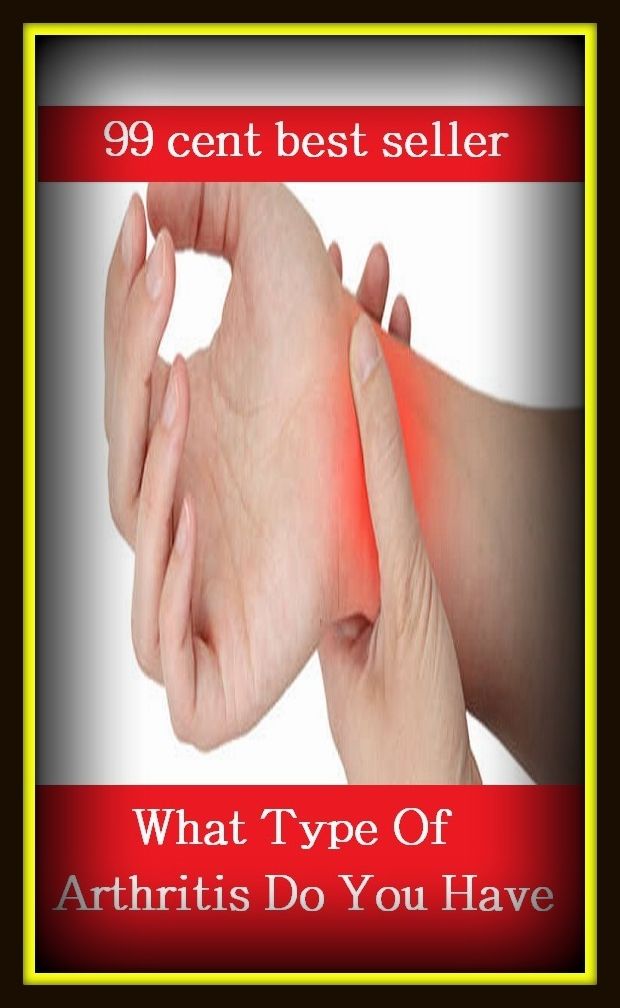 99 Cent Best Seller What Type Of Arthritis Do You Have (Energy, fitness, strength, well-being, bloom, complexion, constitution, euphoria, fettle, form, hardihood, hardiness)