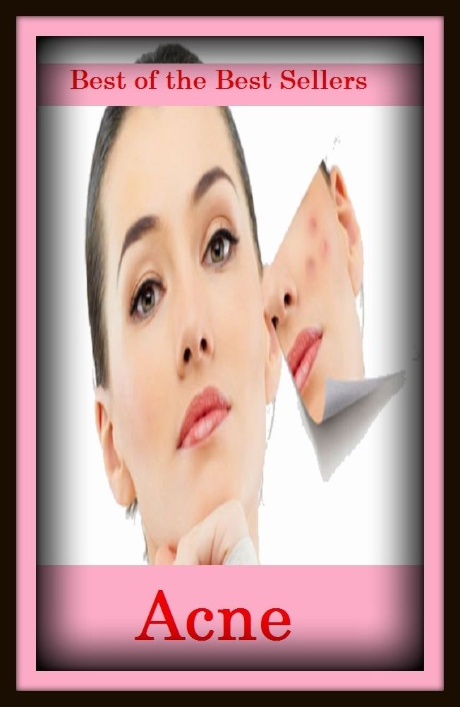 Best of the Best Sellers Acne (Pimples, "zits")