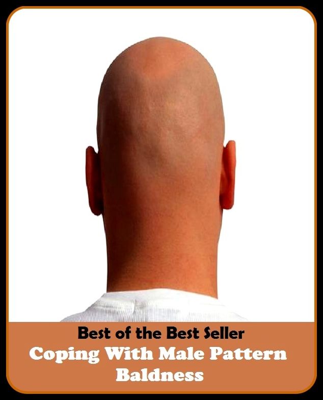Best of the best seller Coping With Male Pattern Baldness(behavior,conduct,habits,style of living,way of acting,act,action,attitude,conduct,demeanor)