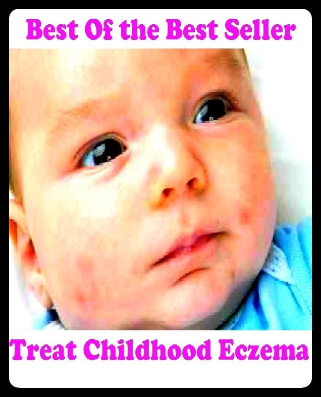 Best of the Best Sellers Treatchildhood Eczema (treat, treat them mean, keep them keen, treat ability, treatable, treatable, treated, treated, treat feed, treaties, treating)