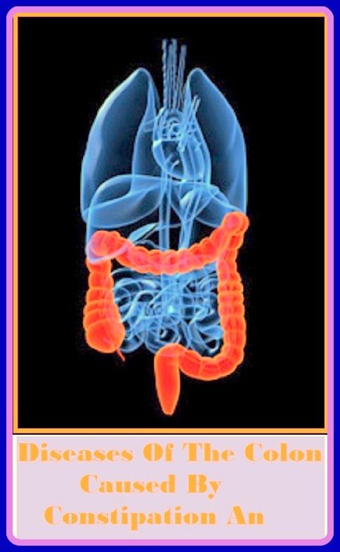 Best of the Sellers Diseases Of The Colon Caused By Constipation An ( exercise, meditation, acupuncture, disease, digestive system, formula, medicine, remedy, fix, treatment, action, conduct, behavior, handling, gastrin, fitness, vitamins, healing, diet )