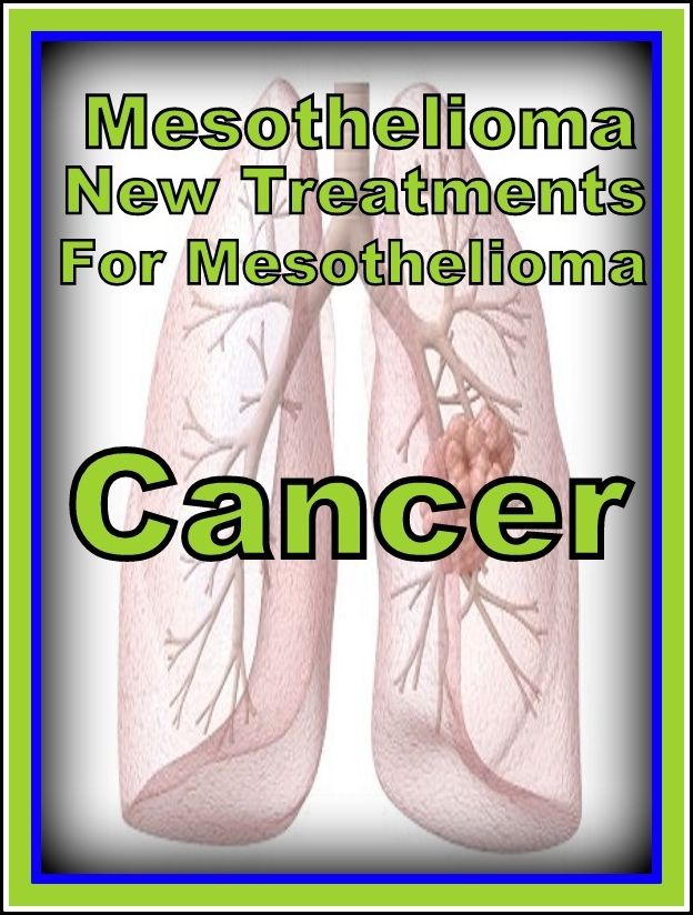 Best of the Sellers Mesothelioma Treatments For Mesothelioma Cancer ( exercise, meditation, acupuncture, disease, digestive system, formula, medicine, remedy, fix, treatment, action, conduct, behavior, handling, gastrin, fitness, vitamins, healing, diet )