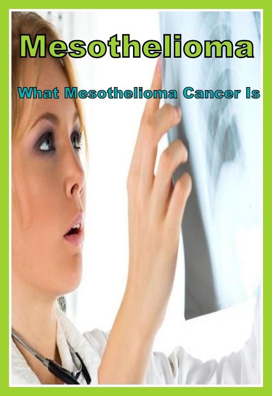 Best of the Sellers Mesothelioma What Mesothelioma Cancer Is ( exercise, meditation, acupuncture, disease, digestive system, formula, medicine, remedy, fix, treatment, action, conduct, behavior, handling, gastrin, fitness, vitamins, healing, diet )