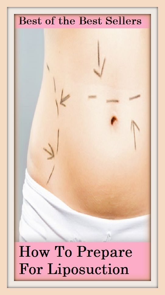 Best of the best sellers How To Prepare For Liposuction ( exercise, meditation, acupuncture, disease, digestive system, formula, medicine, remedy, fix, treatment, action, conduct, behavior, handling, gastrin, fitness, vitamins, healing, diet, cut down )