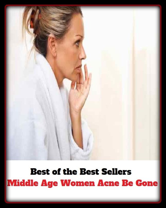 Skincare: Middle Age Women & Acne Gone For Good! (blackheads, pimples, pustules, zits, whiteheads, skin inflammation, pizza face, tumor, eruption)