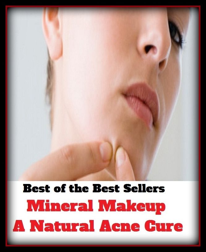 Skincare: Mineral Makeup A Natural Acne Cure (blackheads, pimples, pustules, zits, whiteheads, skin inflammation, pizza face, tumor, eruption