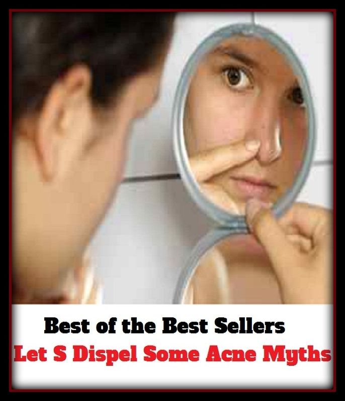 Best of the Best Sellers Let S Dispel Some Acne Myths(blackheads,pimples,pustules,rosacea,zits, whiteheads, skin inflammation, pizza face, tumor, eruption)