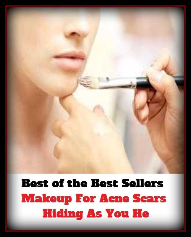 Best of the Best Sellers Makeup For Acne Scars Hiding As You He(blackheads,pimples,pustules,rosacea,zits, whiteheads, skin inflammation, pizza face, tumor, eruption)
