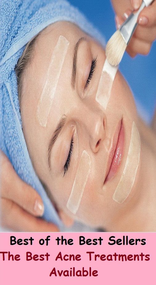 Best of the Best SellersThe Best Acne Treatments Available (blackheads,pimples,pustules,aerospace,zits, whiteheads, skin inflammation, pizza face, tumor, eruption)