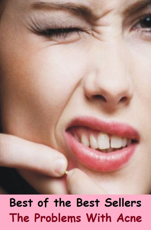 Best of the Best Sellers The Problems With Acne (blackheads,pimples,pustules,rosacea,zits, whiteheads, skin inflammation, pizza face, tumor, eruption)