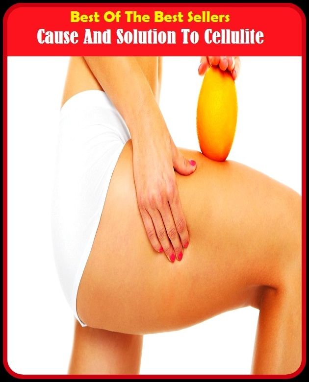 Best of the Best Sellers Cause And Solution To Cellulite ( castor, cause, cause & effect, cause a stir, cause and effect, cause celebre, cause celebre, cause cu00e9lu00e8bre, cause of action, cause of death )