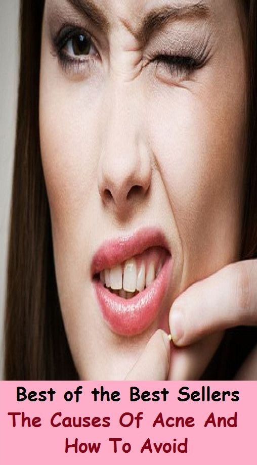 Best of the Best Sellers The Causes Of Acne And How To Avoid T (blackheads,pimples,pustules,rosacea,zits, whiteheads, skin inflammation, pizza face, tumor, eruption)