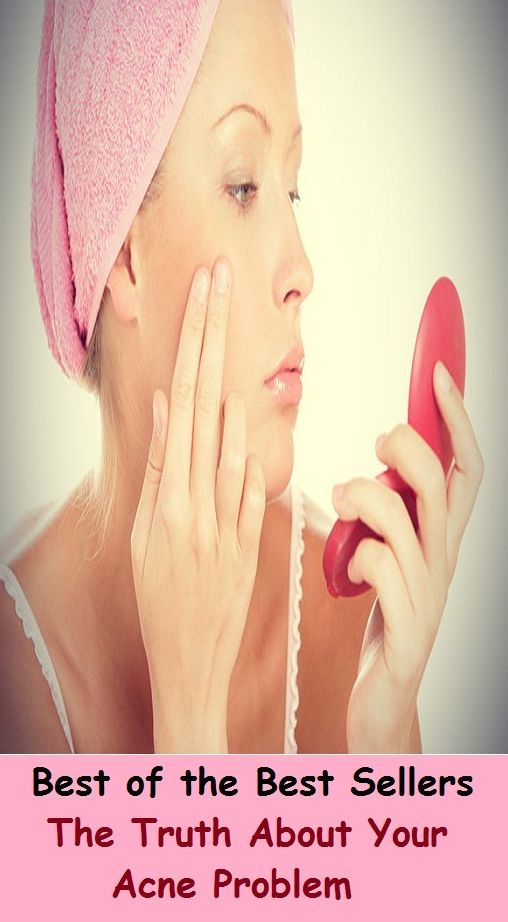 Best of the Best Sellers The Truth About Your Acne Problem (blackheads,pimples,pustules,rosacea,zits, whiteheads, skin inflammation, pizza face, tumor,eruption)