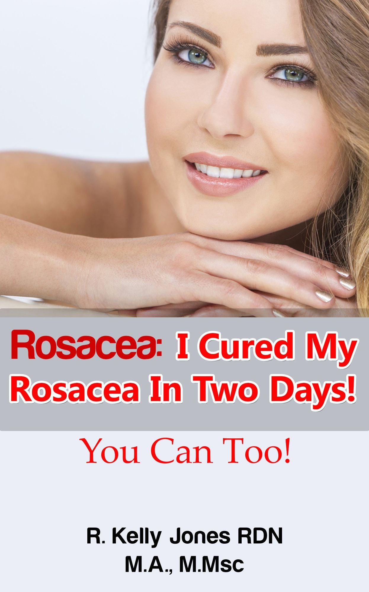 Rosacea: How I Cured My Rosacea In Two Days! You Can Too!