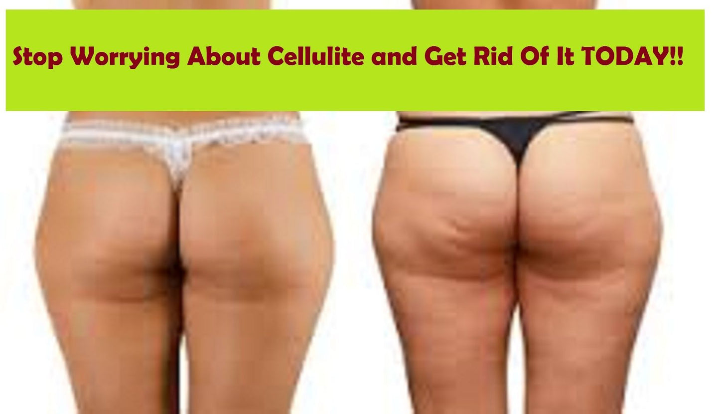 Stop Worrying About Cellulite And Get Rid Of It Today!