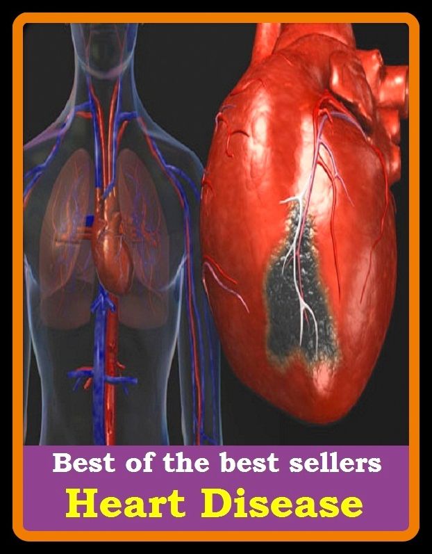Best of the best sellers Heart Disease ( heart disease, cardiograph)